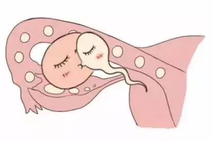 私人志愿者代孕服务怎么选生殖中心